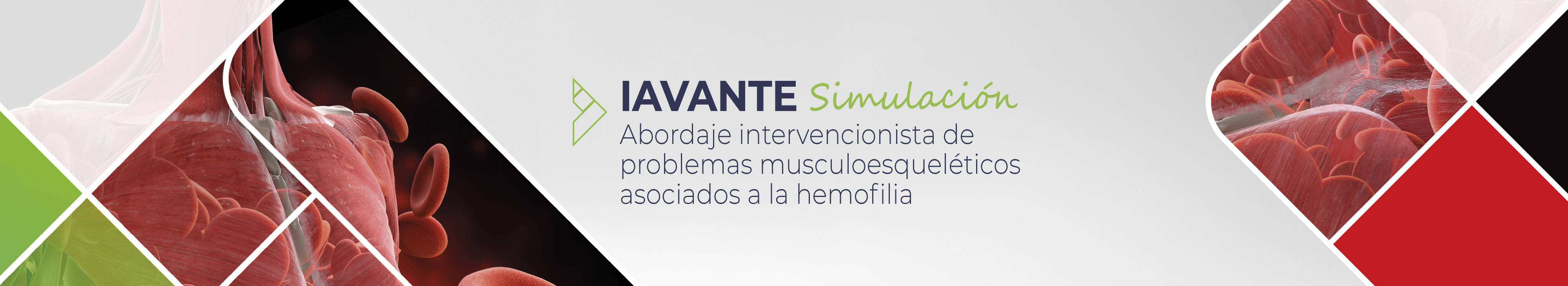 Logo Vasculitis ANCA 360
